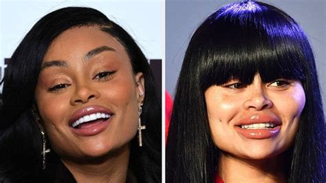 blac chyna before and after 2023|is blac chyna alive.